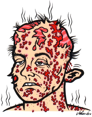 "FLESH-EATING BACTERIA" is copyright &copy;2008 by Jim Blanchard.  All rights reserved.  Reproduction prohibited.